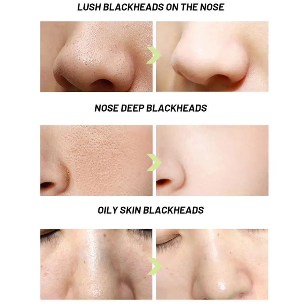 Remover Cravos Máscara De Acne De Limpeza Facial Mascara Facial Cleanser Nariz Pore Minimizer Redução De Óleo E De Água De Equilíbrio