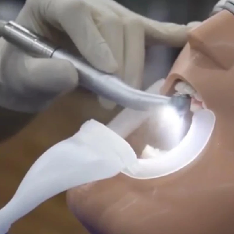 1PC Dental Abridor de Boca de Lábios, Bochecha Afastador Dentista Ortodontia Ferramenta intra-oral Difusor Anti Oral Gotas de Respingos